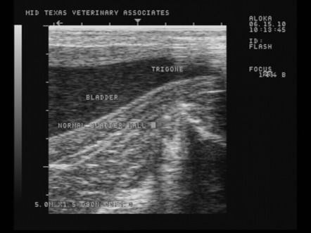 Ultrasound image of normal bladder